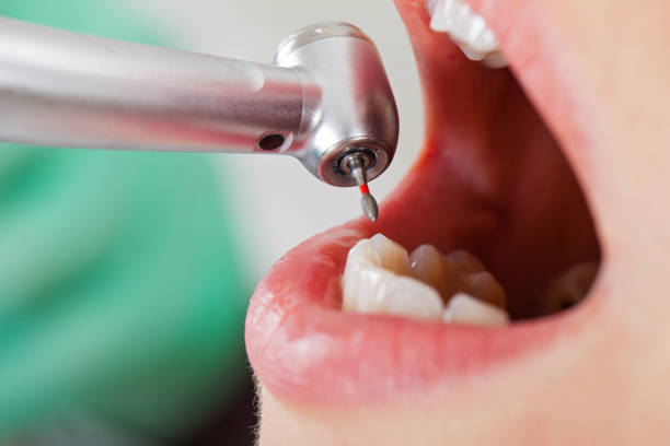 Best Emergency Cosmetic Dentistry in Seville, FL